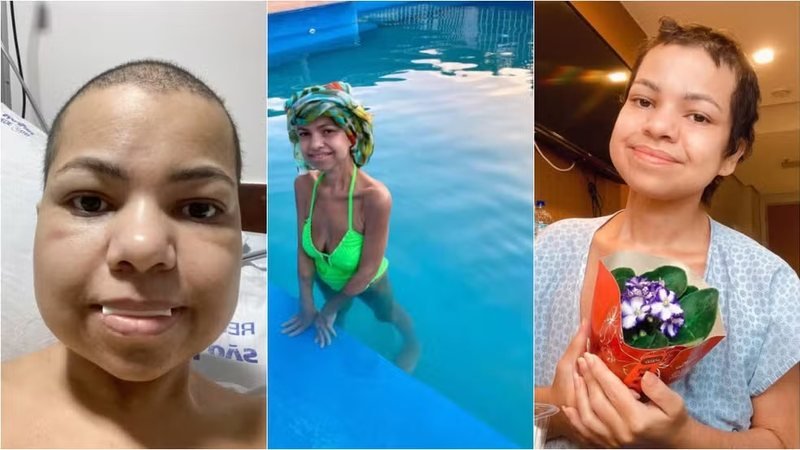 Após Cirurgia Bariátrica, Jovem Luta Contra Efeitos Colaterais e Chega a Pesquisar Apenas 32 kg