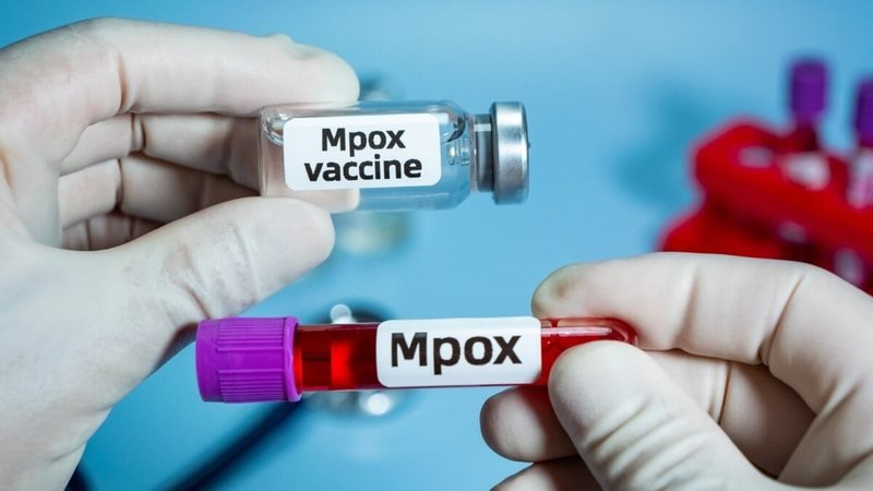 Brasil Reporta 88 Casos de Mpox em 2026: Medidas Essenciais para Prevenir a Doença