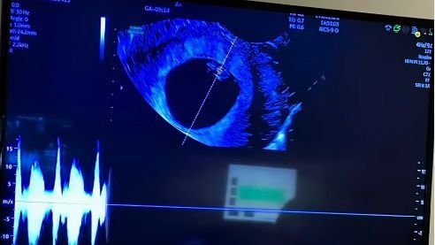 Ex-BBB Revela Espera de Primeiro Filhote: 'Momento Mais Especial da Minha Vida'