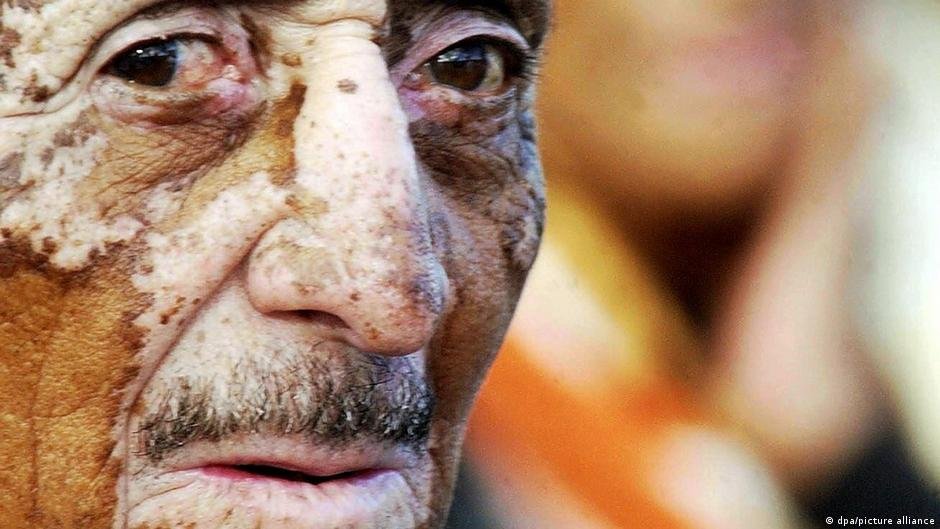 França Desconsidera Reivindicações de Nicaraguenses Afetados por Agrotóxicos: Um Olhar Sobre a Justiça Ambiental