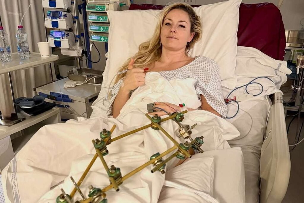 Olimpíadas de Inverno 2026: Lindsey Vonn Revela Imagens Impactantes de Recuperação Após Cirurgia na Perna