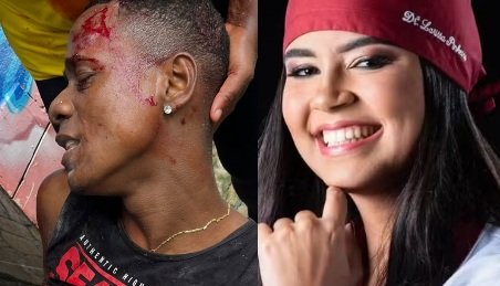 Suspeito de Tráfico é Morto na Gamboa: Investigação Revela Ligações com Homicídio de Dentista na Paralela