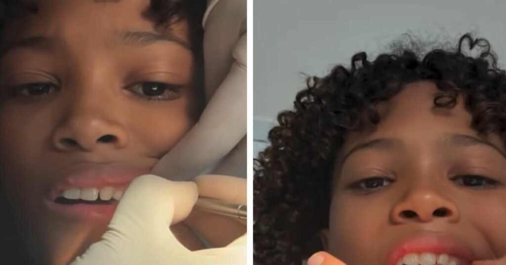 criança arranca próprio dente antes de dentista terminar procedimento