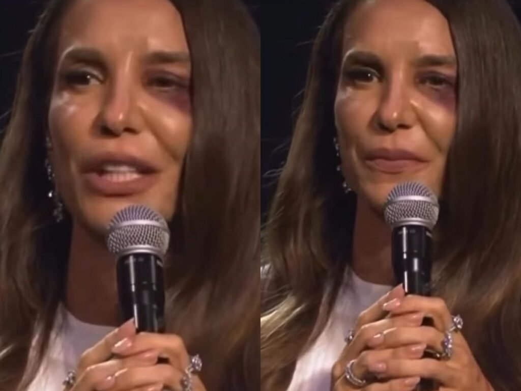 Ivete Sangalo se Prepara para Cirurgia Neste Domingo (1); Confira Todas as Informações Importantes