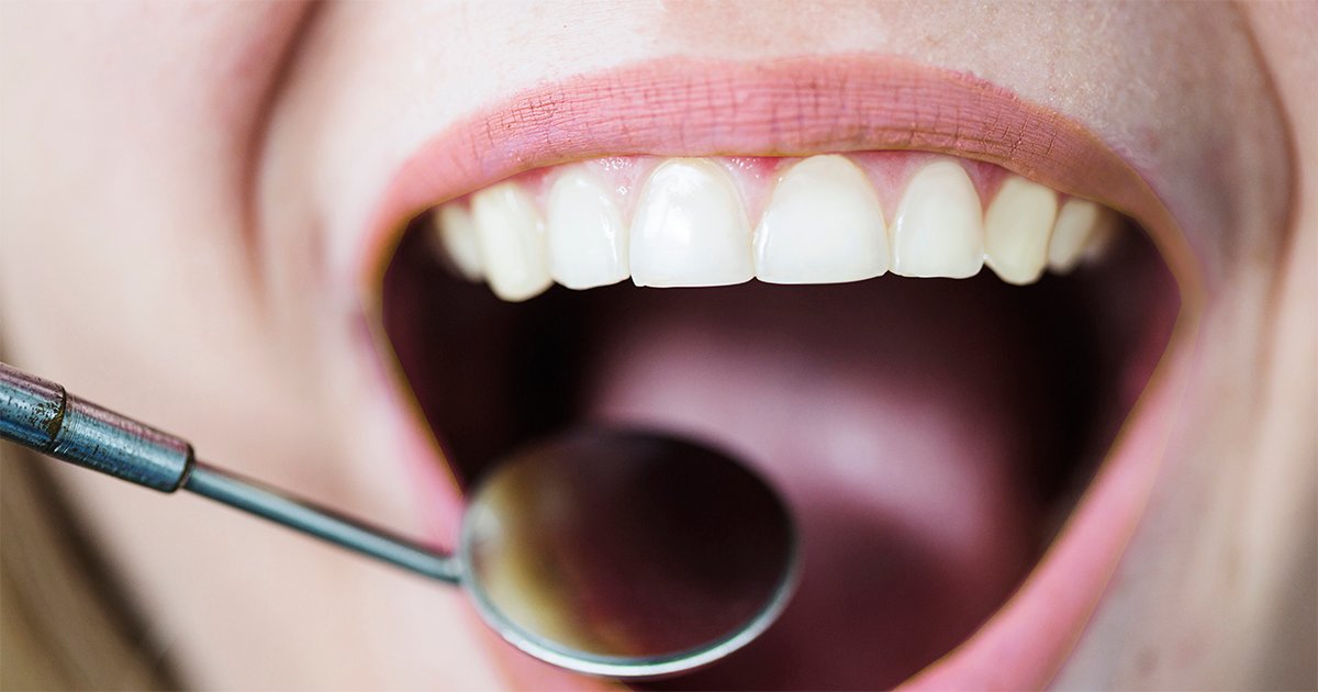 Imagem da boca aberta de uma mulher branca sob exame de um aparelho odontológico