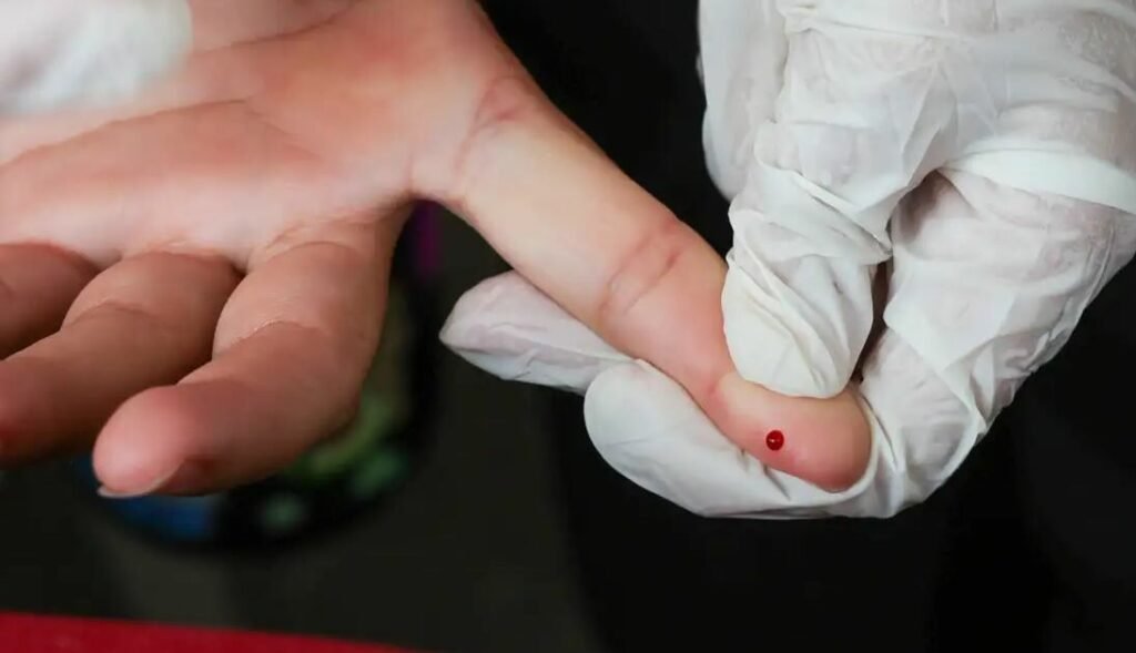 SUS passa a oferecer teste rápido de dengue