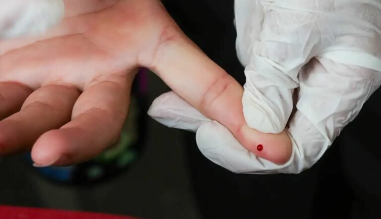 SUS passa a oferecer teste rápido de dengue