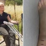 Adolescente em estado grave após picada de cascavel em passeio Adolescente em estado grave após picada de cascavel em passeio