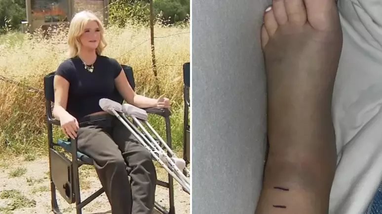 Adolescente em estado grave após picada de cascavel em passeio