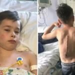 Adolescente paralisado após despertar: sonho de boxeador em risco