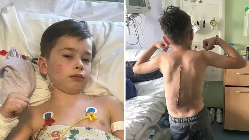 Adolescente paralisado após despertar: sonho de boxeador em risco