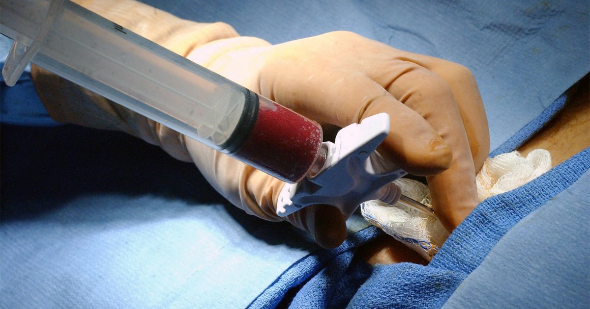 Terapias inovadoras no HC impulsionam avanço nas técnicas de transplante de medula óssea – Jornal da USP