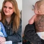 Bebê nasce com doença rara: manchas escuras na pele preocupam médicos Bebê nasce com doença rara: manchas escuras na pele preocupam médicos