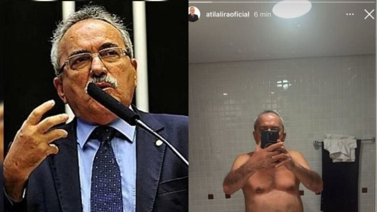 Ex-deputado gera polêmica ao postar nude acidentalmente na web