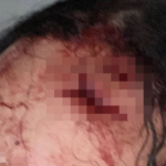 Homem agressor usa garrafa e faca após rejeição amorosa