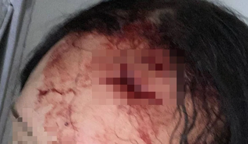 Após levar fora, homem ataca mulher com garrafa de vidro e faca