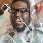 Infecção grave após consulta odontológica leva homem a amputações Infecção grave após consulta odontológica leva homem a amputações