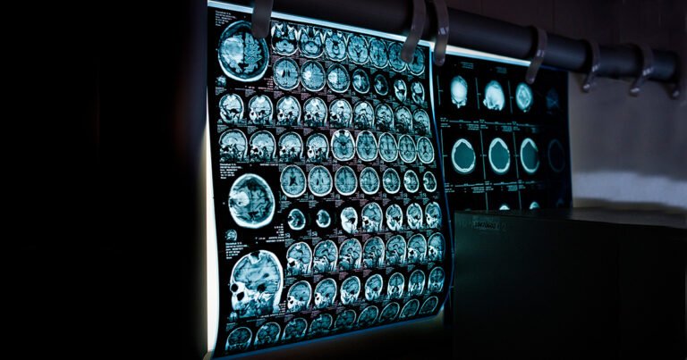 Intervenções preventivas de longa duração são importantes para o cérebro no envelhecimento – Jornal da USP