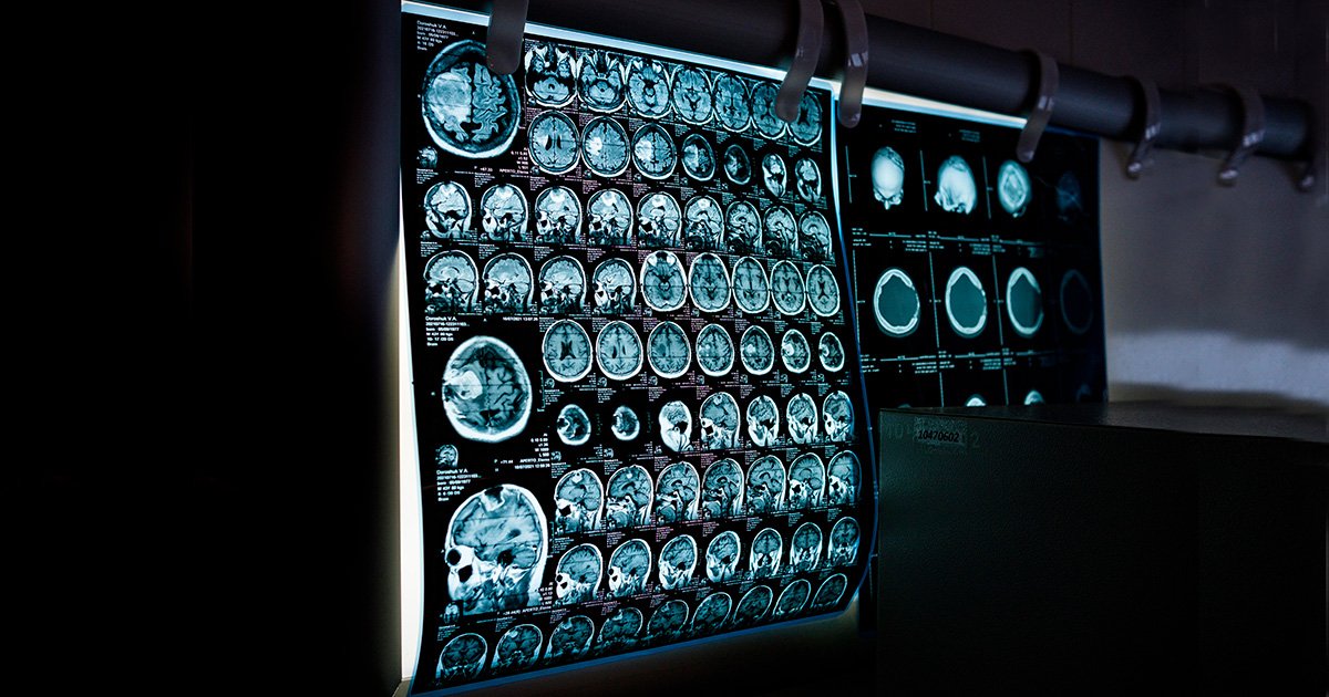 Intervenções preventivas de longa duração são importantes para o cérebro no envelhecimento – Jornal da USP