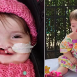 Mãe de bebê com fissura labial fala sobre dor emocional causada