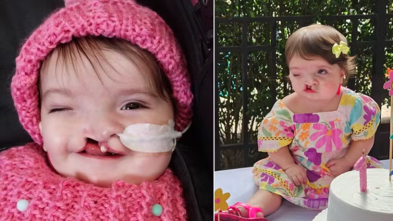 Mãe de bebê com fissura labial fala sobre dor emocional causada