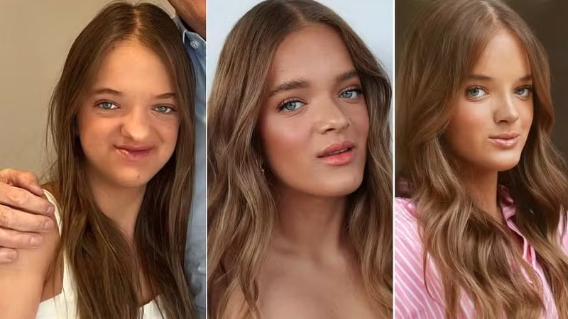 Rafa Justus: Transformações Após Sua Segunda Cirurgia Nasal