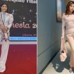 Ex-miss é detida por falsidade ao realizar cirurgias plásticas