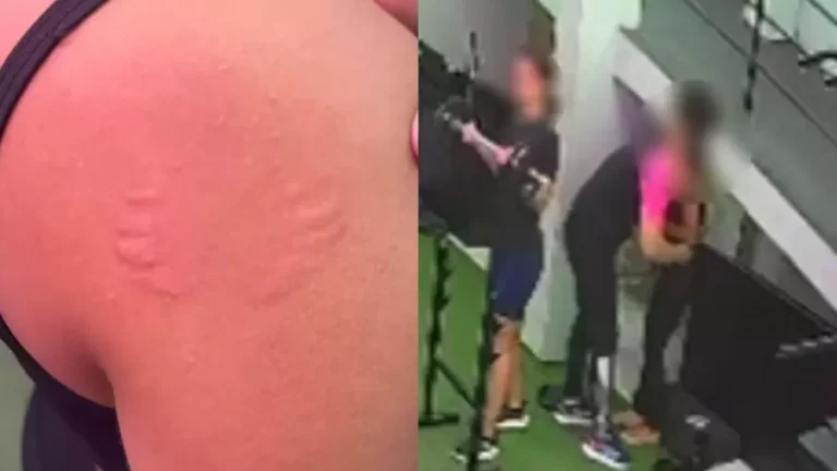 Instrutor de academia no Recife é acusado de assédio após mordida